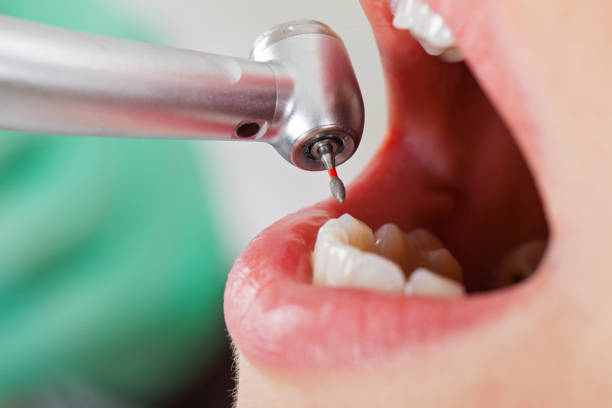 Best Emergency Dental Care for Abscessed Tooth in Wilburton, OK